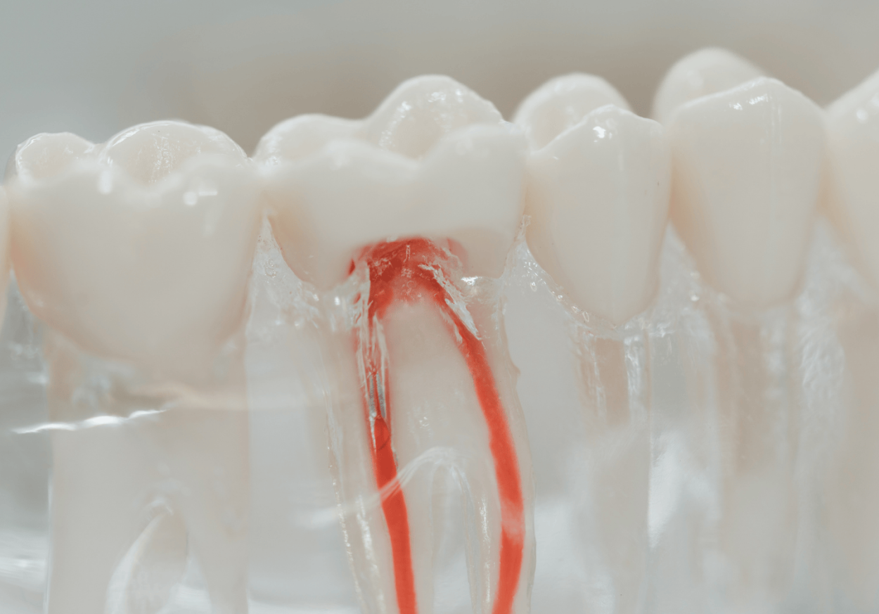 Endodontics at darren bywater