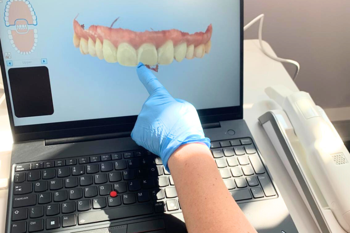 Digital 3D Scanner